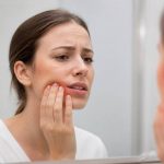 Abcès gingival : traitement naturel et conseils pour soulager la douleur